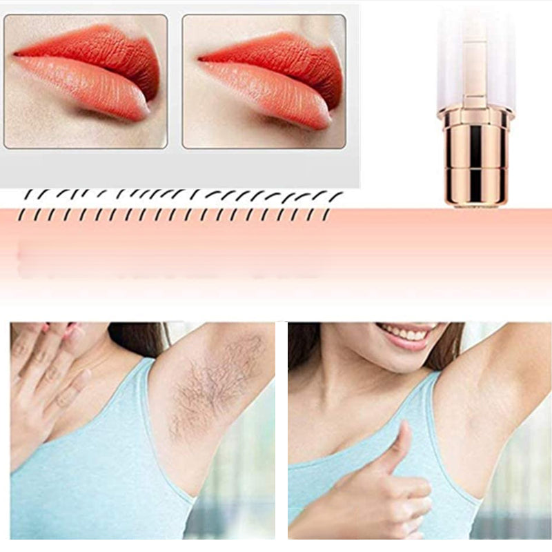 Norvo | Epilator