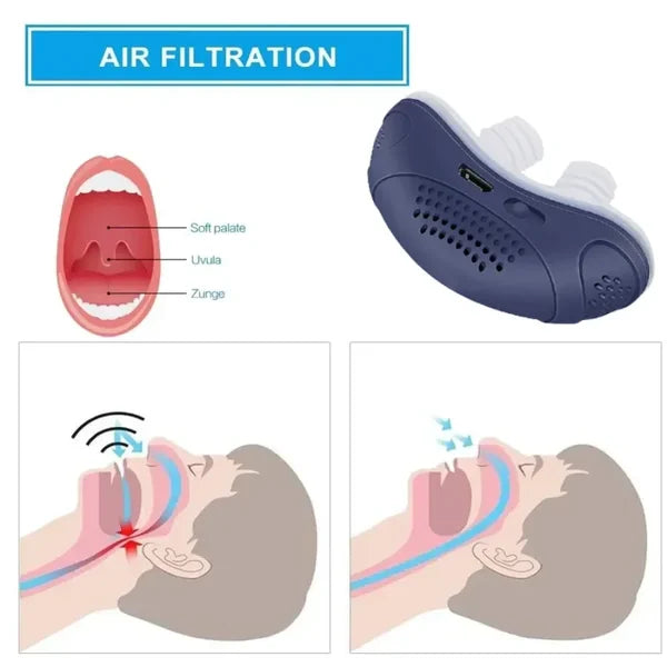 Norvo | Søvnløs, maskefri, Micro-CPAP Anti-Snorking