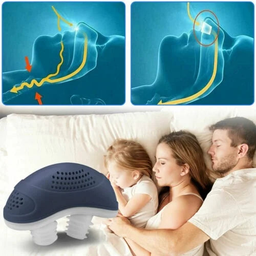 Norvo | Søvnløs, maskefri, Micro-CPAP Anti-Snorking
