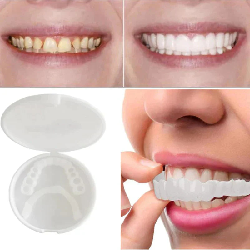 Norvo | SnapFit Dental Restoration | Alltid et feilfritt smil