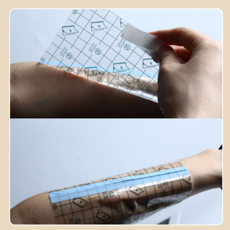 Norvo | Vanntett Transparent Bandasje