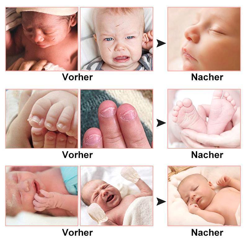 Norvo | Elektrisk neglefil for baby