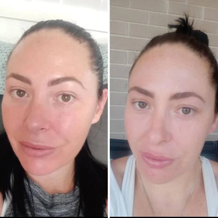 Norvo | LED Ansiktsmaske Lysbehandling Hudpleie Enhet