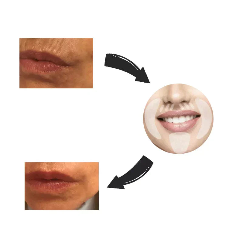 Norvo | Ansiktsløft Gjenbrukbart Tape