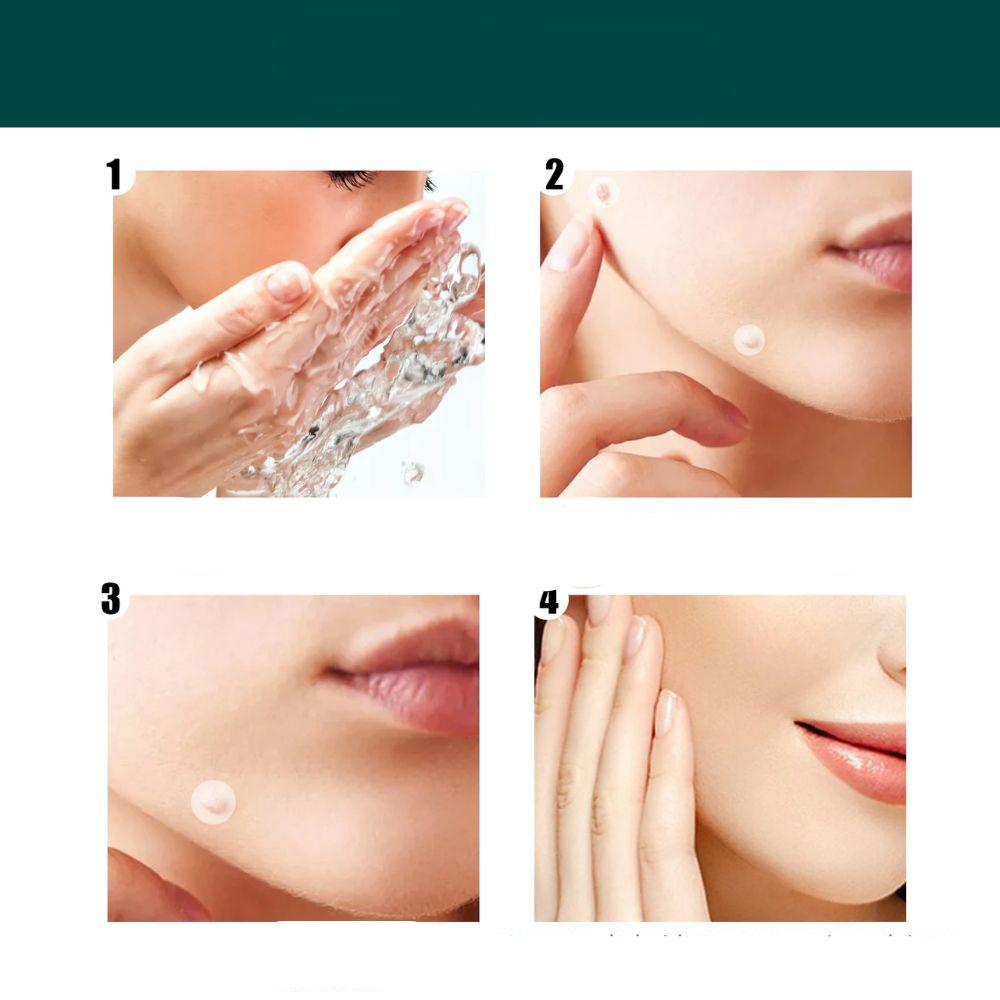 Norvo | SkinClear - Plaster for the removal of spots and warts