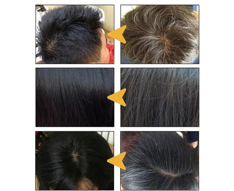 Norvo | Anti Grått Hår Sjampo Behandling