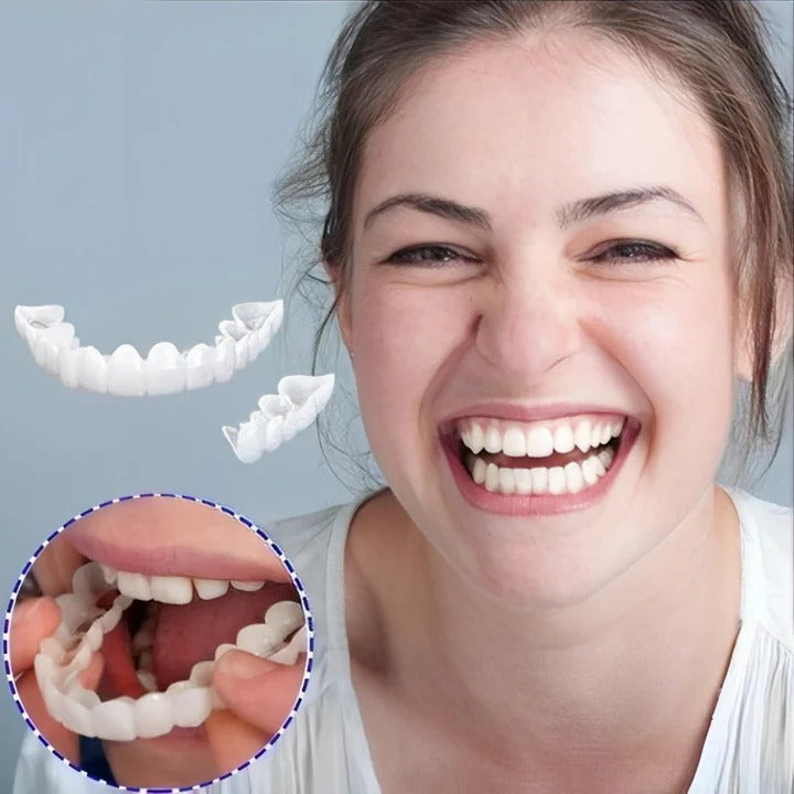 Norvo | Avtagbare Smile Veneers for Øvre og Nedre Tenner