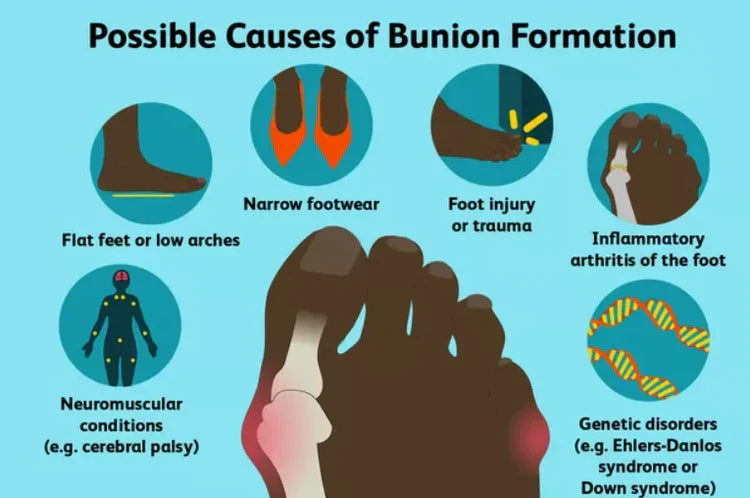 Norvo | BunionGuard™ | Bunion Korrektor for Smertelindring & Justering | Justerbar Ortopedisk Støtte for Alle Fottstørrelser