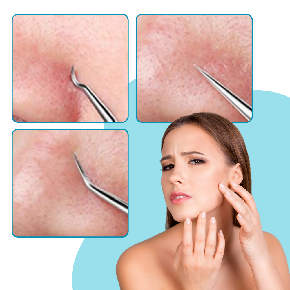 Ultrapresis spiss pinsett
