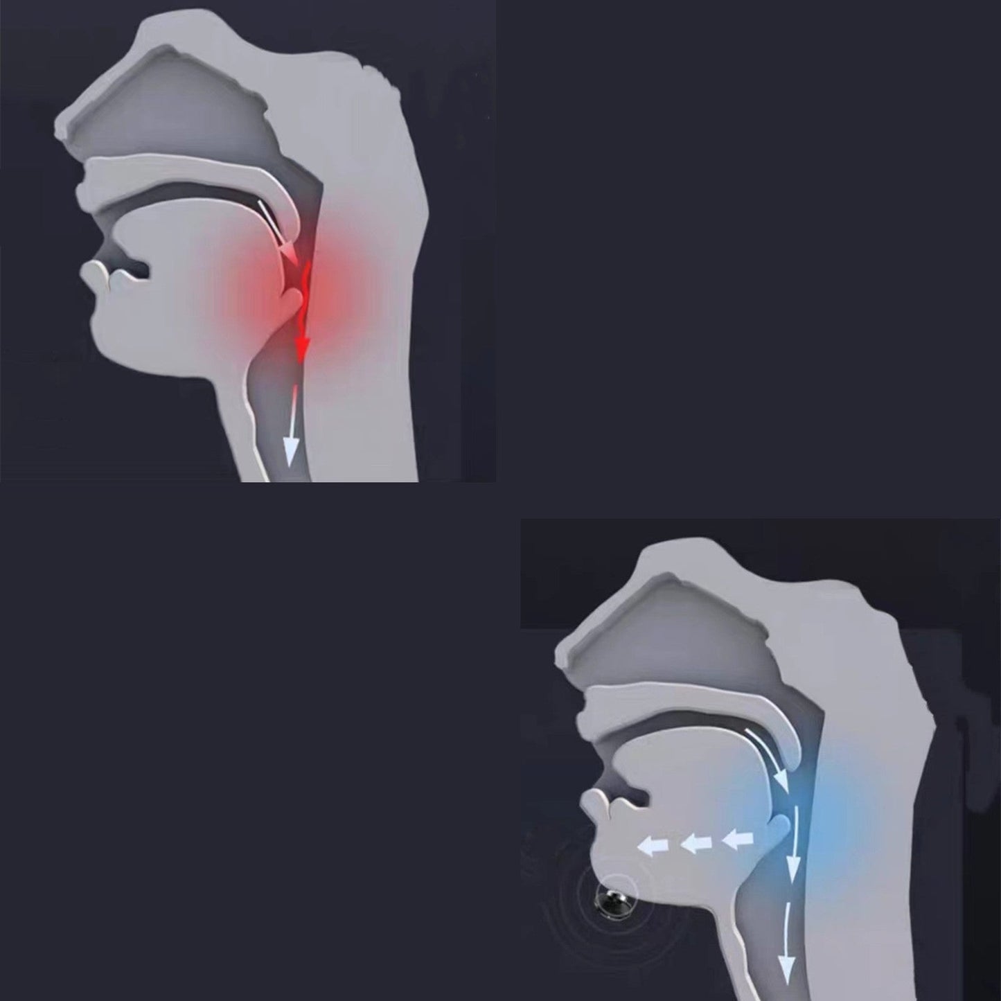 Norvo | Premium Antisnorke-enhet, for menn og kvinner