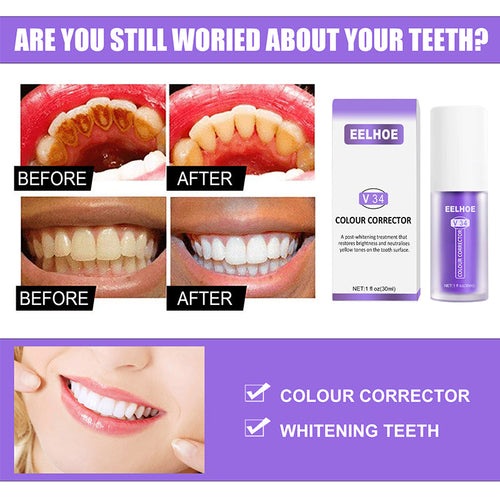 Norvo | Dental Color Corrector