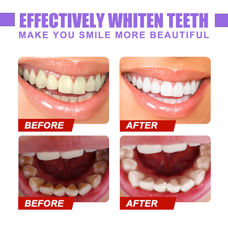 Norvo | Dental Color Corrector