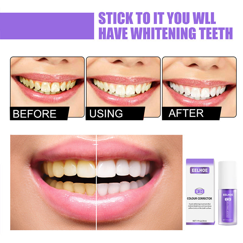 Norvo | Dental Color Corrector