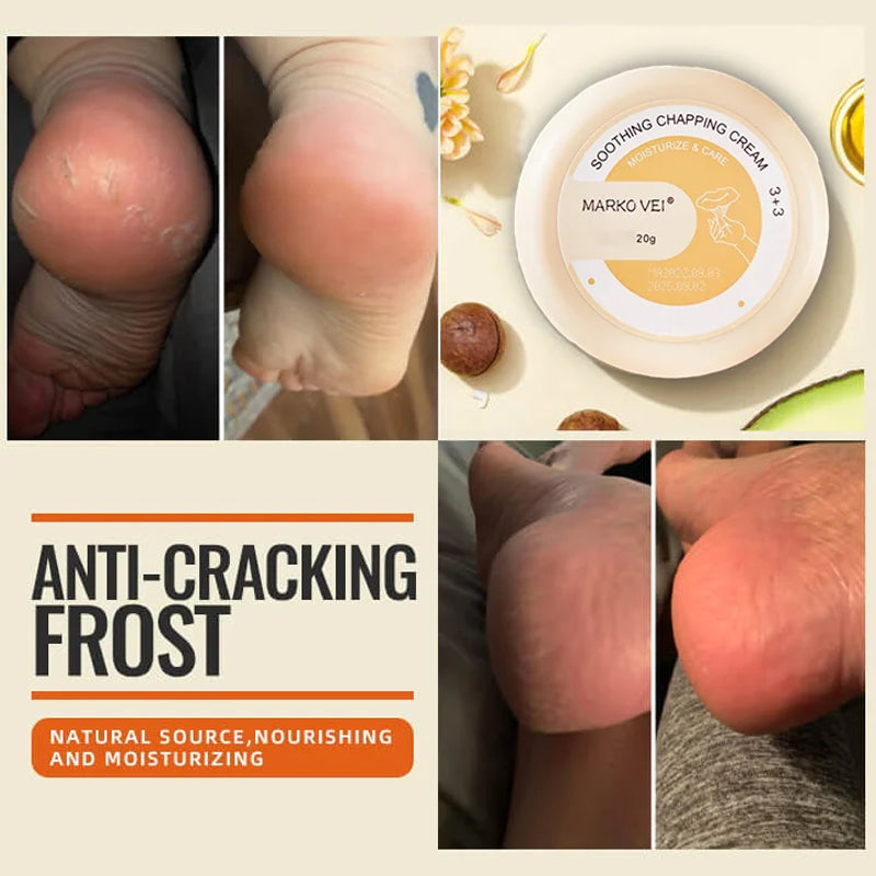 Winter Anti-Rip Frost | Norvo