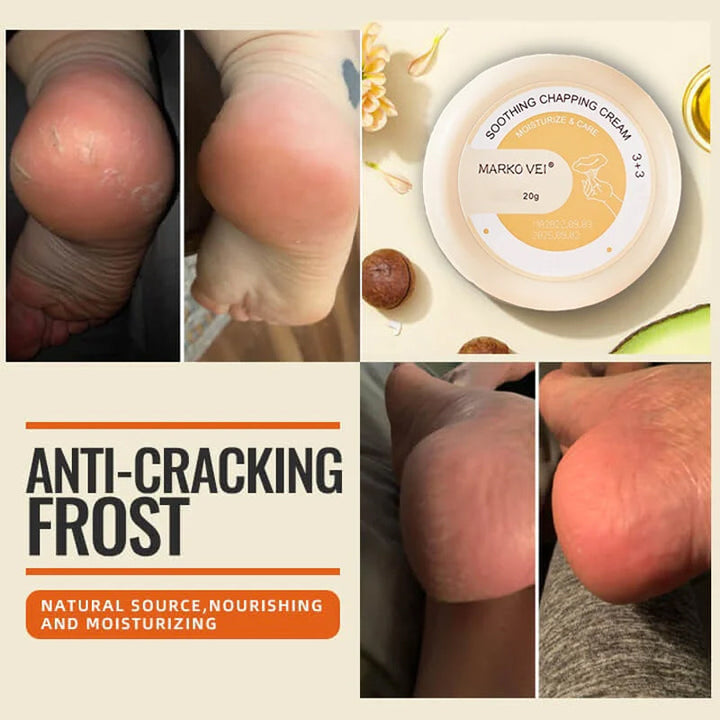 Winter Anti-Rip Frost | Norvo