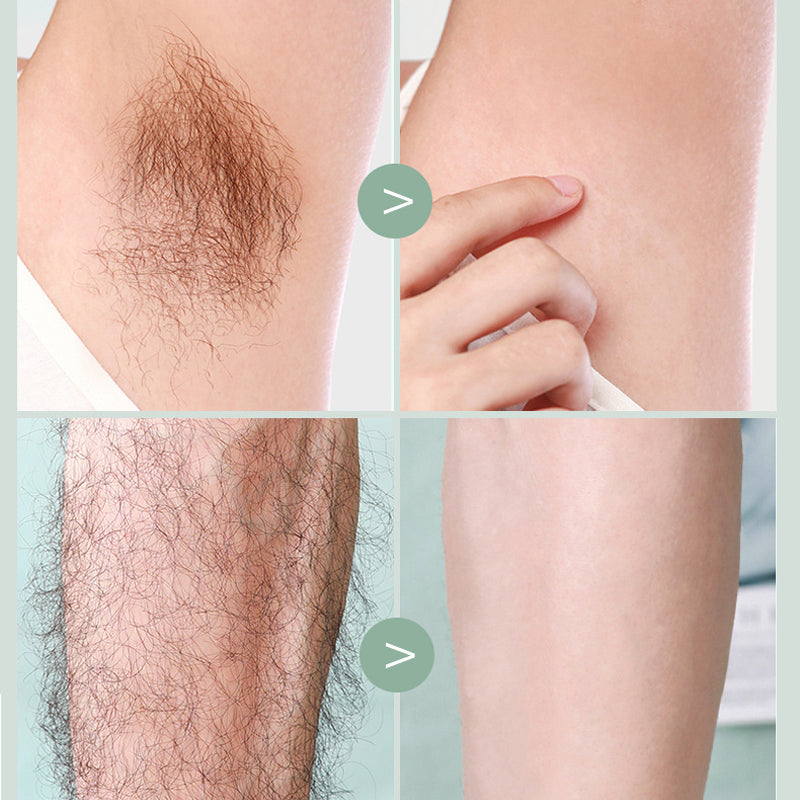 Norvo | Depilasjon Kniv