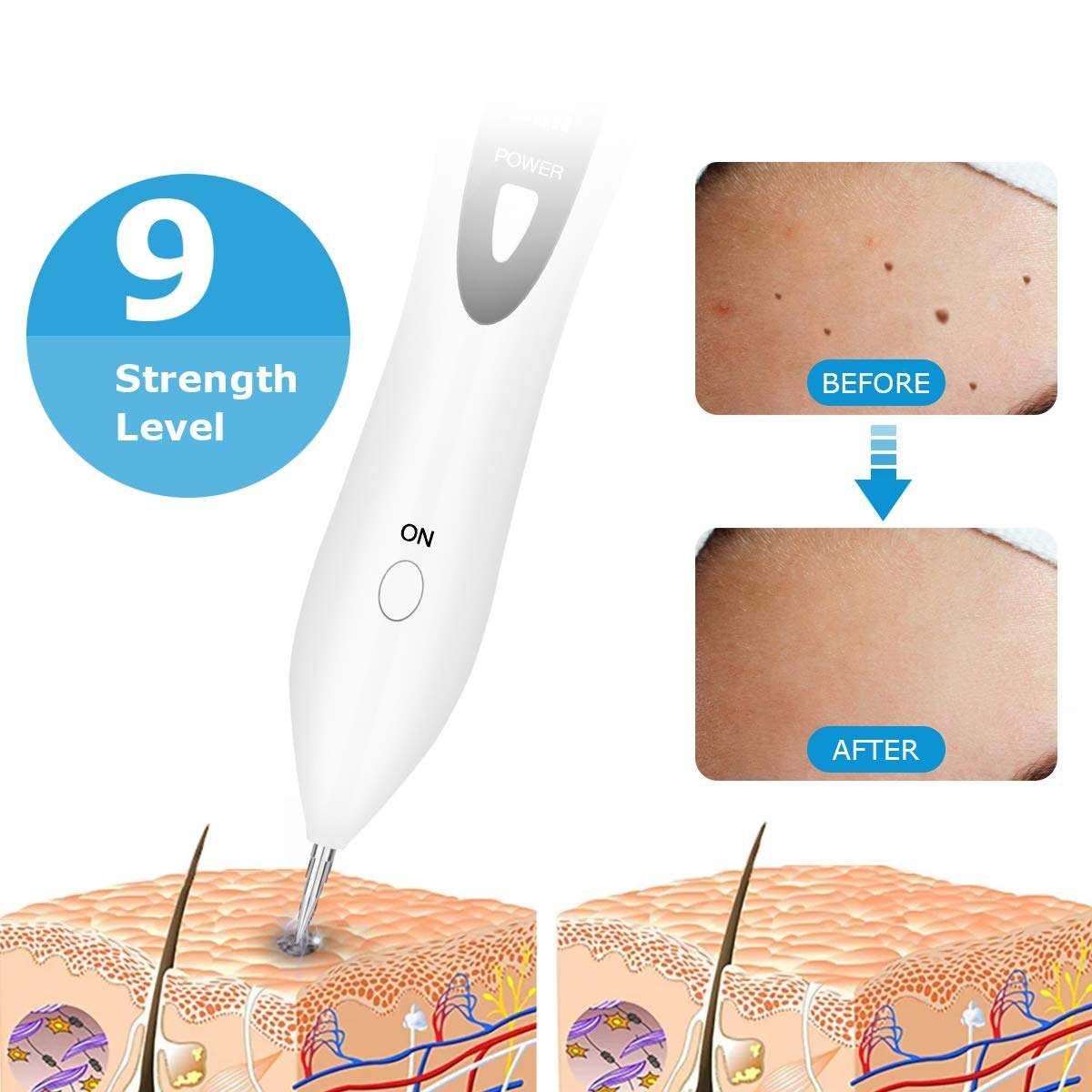 Norvo | Bærbart skjønnhetsutstyr Multi-Level hudpleie skjønnhet