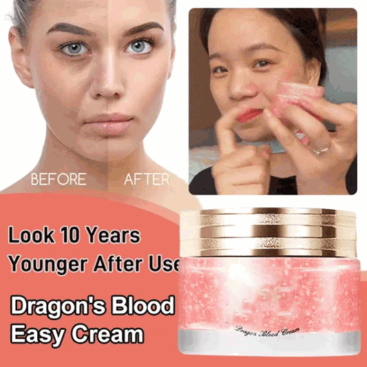 Norvo | DRAGONS BLOOD EASY CREAM