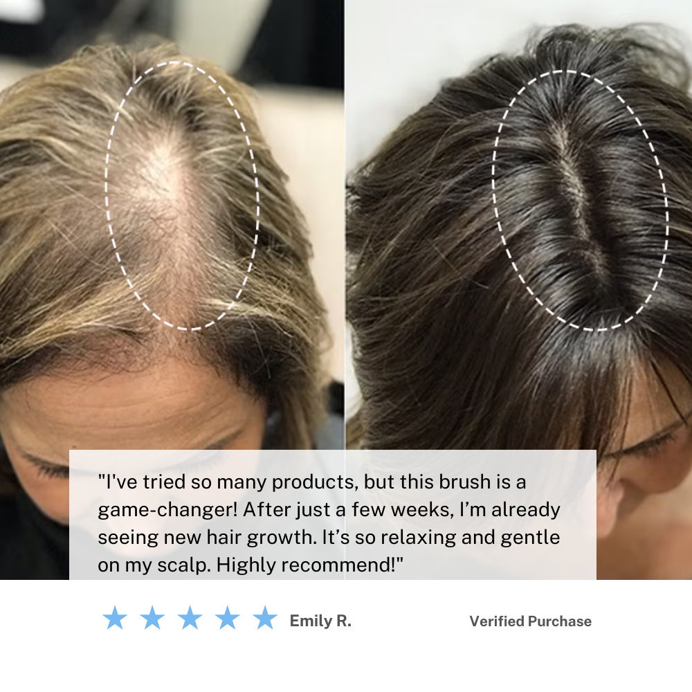 Norvo | Trådløs hodebunn masserende børste – Øk hårvekst og slapp av hjemme