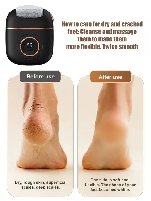 Norvo | 2025 Ny digital elektrisk fotpoleringsmaskin