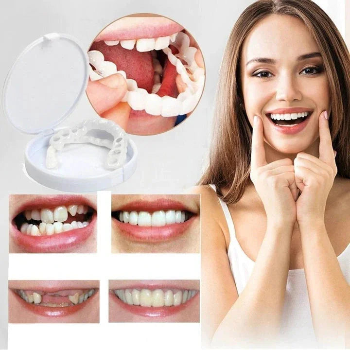 Norvo | Umiddelbar Smile Transformasjon med Snap on Smile Filler