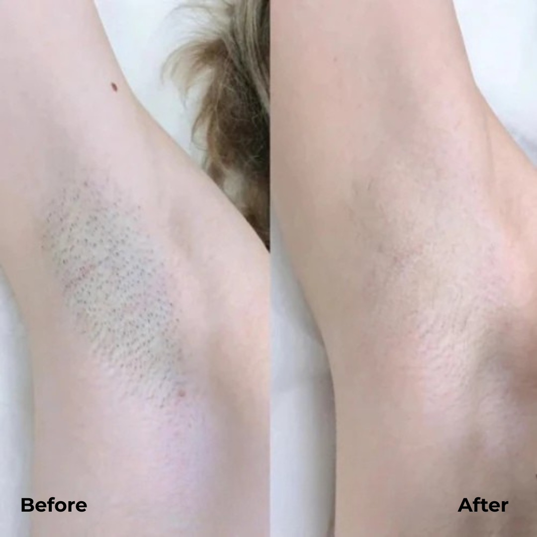 Norvo | DualTrim Presisjon Barbering Komfort