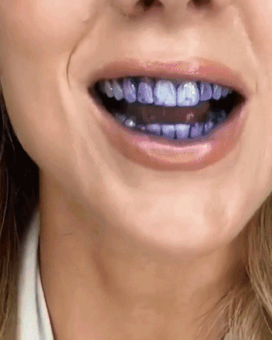 Norvo | Dental Color Corrector
