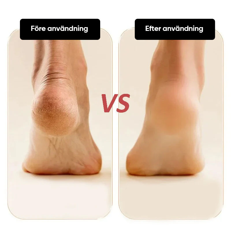 Norvo | Elektrisk Fotfil