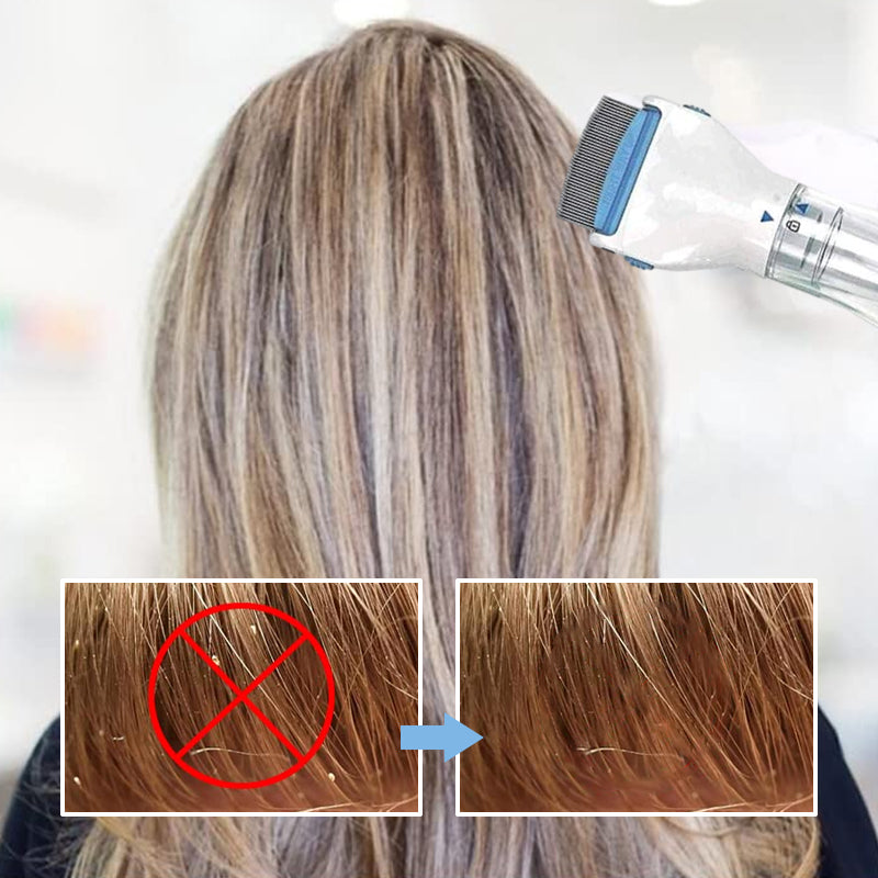 Norvo | V-Comb Hodelus Maskin Med 3 Filtre