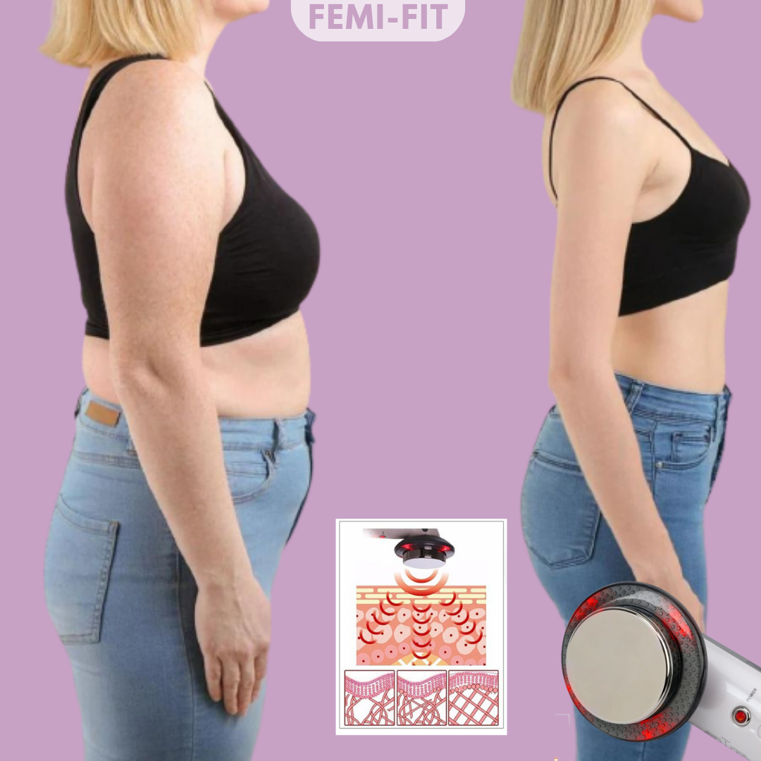 Norvo | 3-i-1 Vet og Cellulite Fjerner - SlimShape