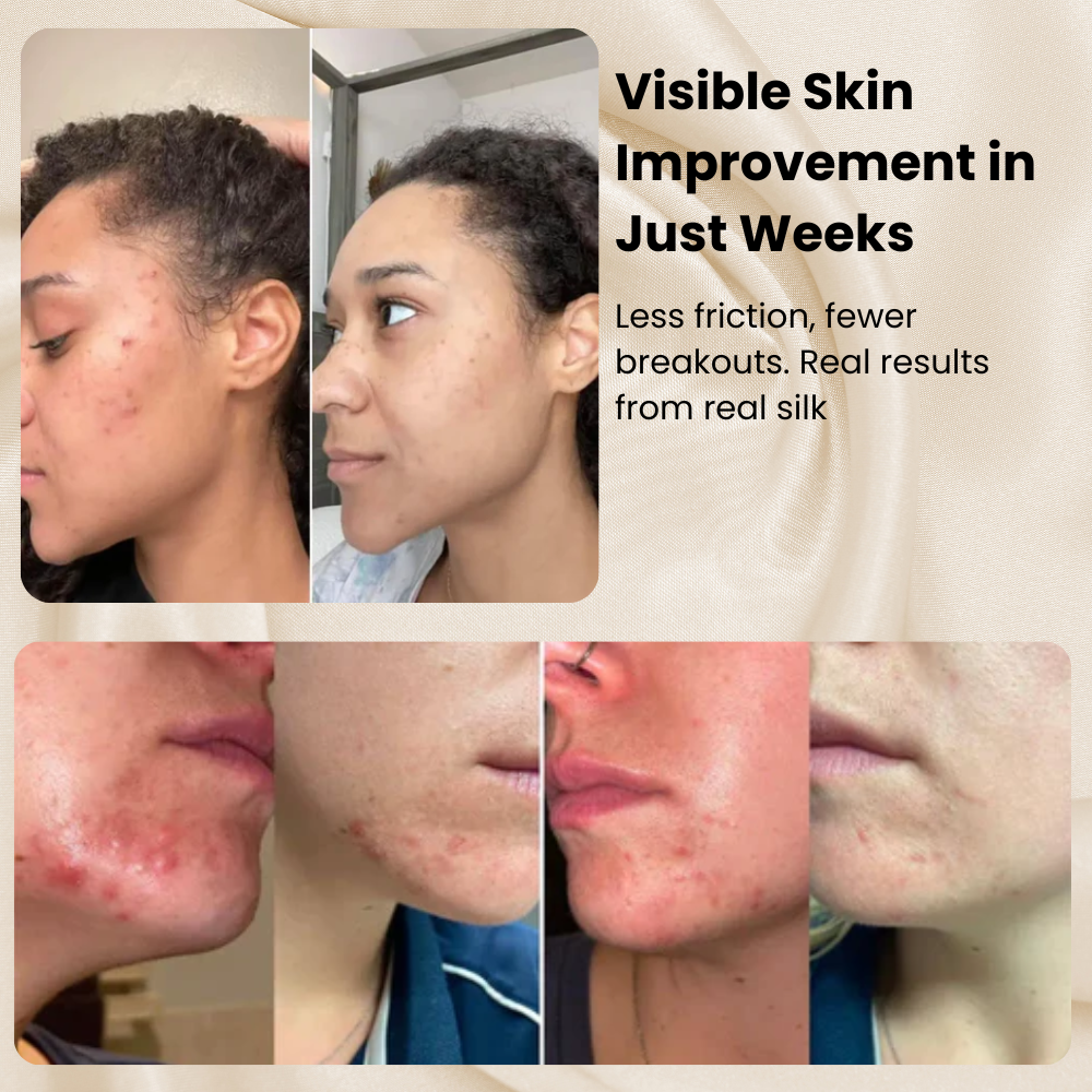 Norvo |Silkeputetrekk – 100% ekte mulberrysilke for hår og hud – Kjølende, frizz-fri & rynkefritt putetrekk UK