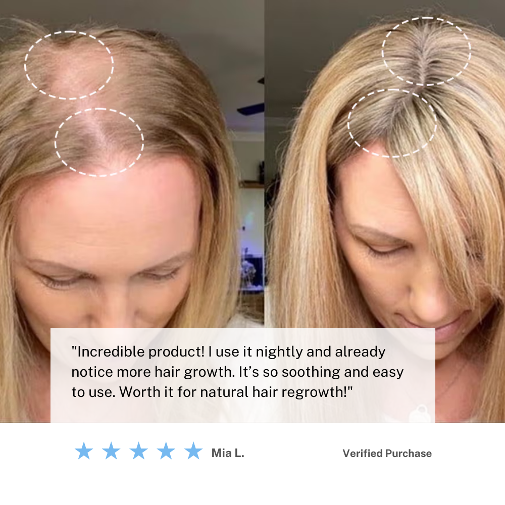 Norvo | Trådløs hodebunn masserende børste – Øk hårvekst og slapp av hjemme