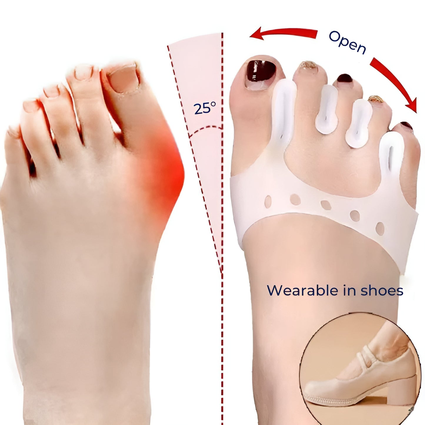 Smertelindring – Myk silikonpolstring – Forbedrer justeringen – Komfort hele dagen Norvo