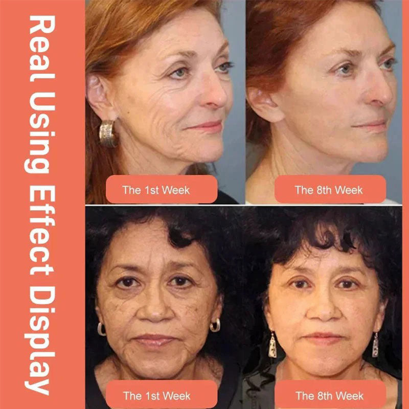 Norvo | DRAGONS BLOOD EASY CREAM