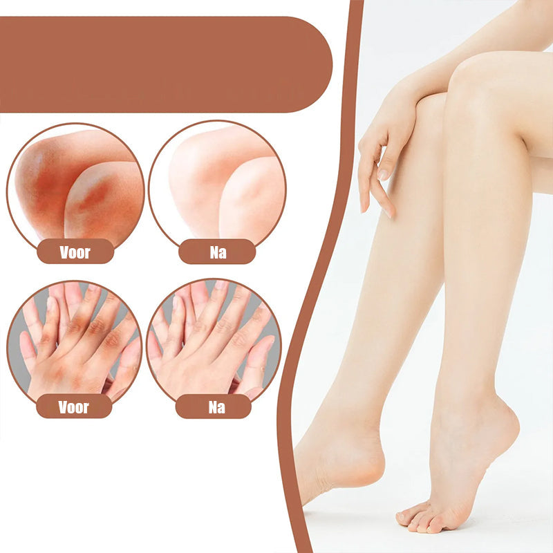 Norvo | Kne og albuer sterk blekemiddel krem