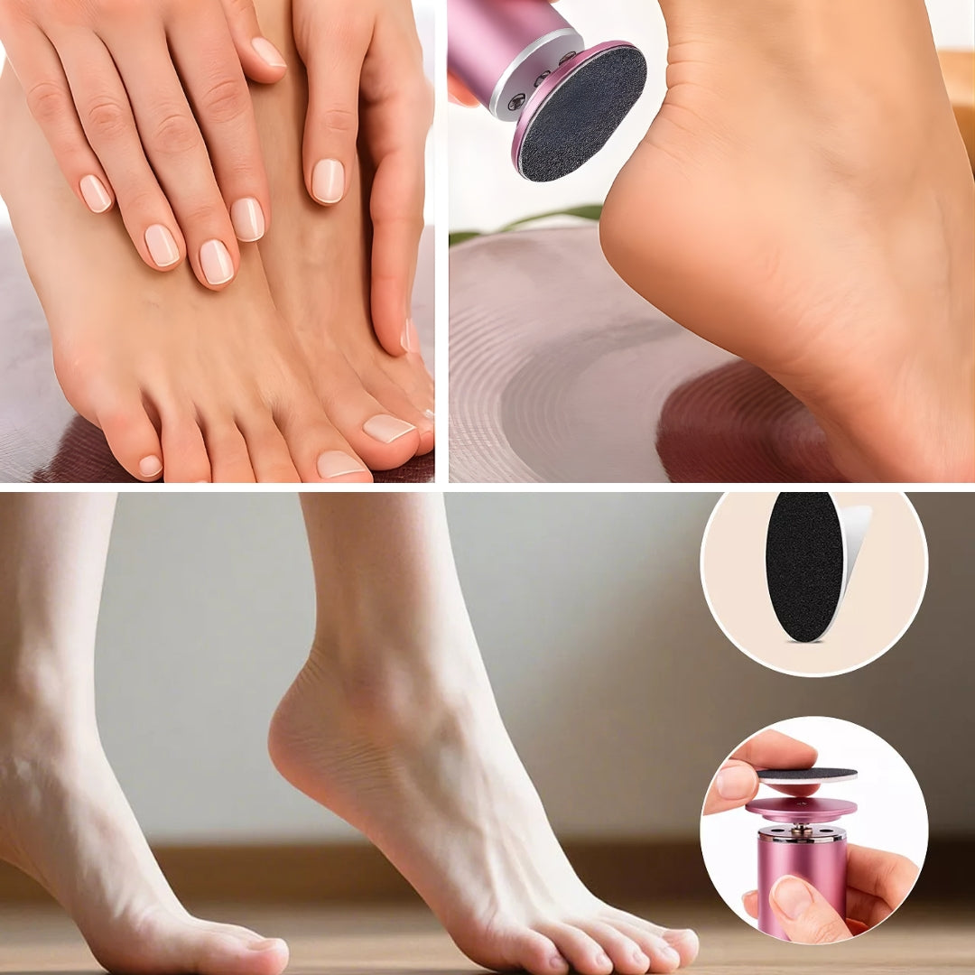 Fjerning av hard hud – Vanntett oppladbar – Gjenoppretter myke glatte føtter umiddelbart Norvo