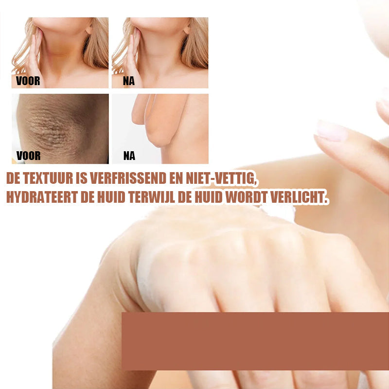 Norvo | Kne og albuer sterk blekemiddel krem