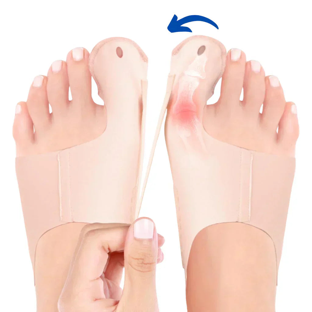 Norvo | OrthoFlex – Komfortabel gåing med Hallux Valgus lindring!