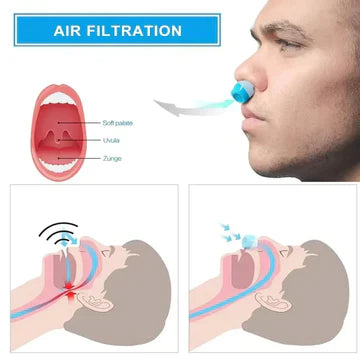 Norvo | Mikro CPAP søvnapné maskin for reise og anti-snorking – CPAP alternativ