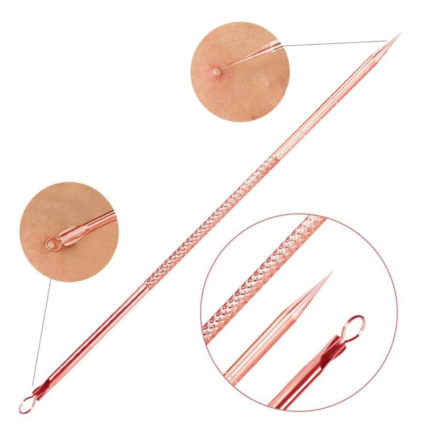 Norvo | Svarthead og kvise fjerning sett