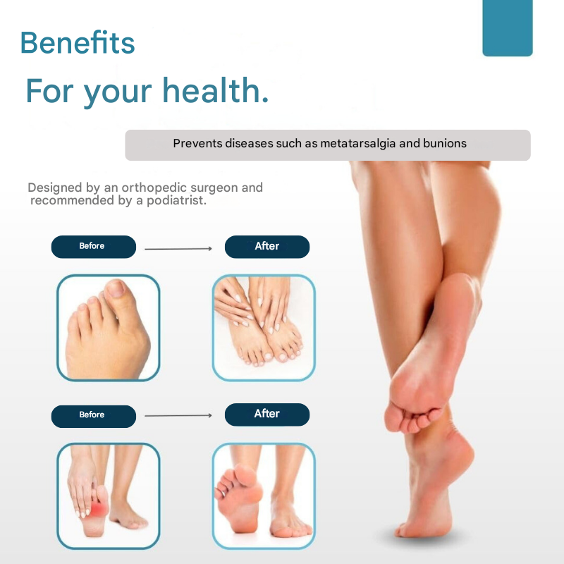 Norvo | FlexiToe Komfort Tåseparator med Fotsåle – Smertelindring & Korrigering for Daglig Bruk