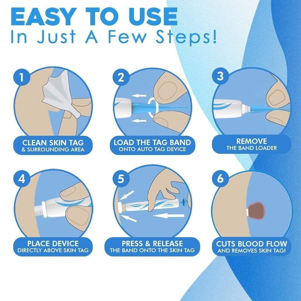 Norvo | SmoothZap — Raskere hudfrihet uten smerte for en ny følelse av selvtillit på bare 10 dager