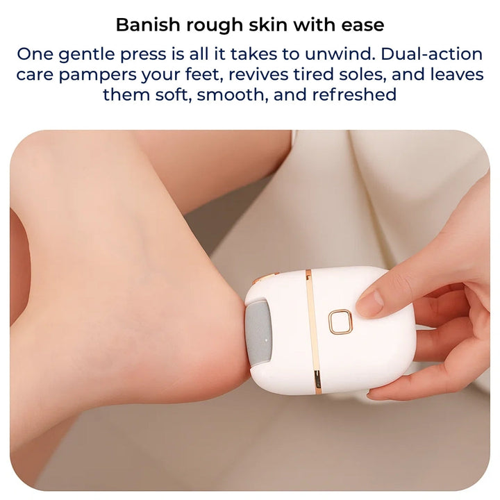 Callus Remover – Oppladbar trådløs – Leger sprukne hæler – Gjenoppretter myke, glatte føtter hjemme Norvo