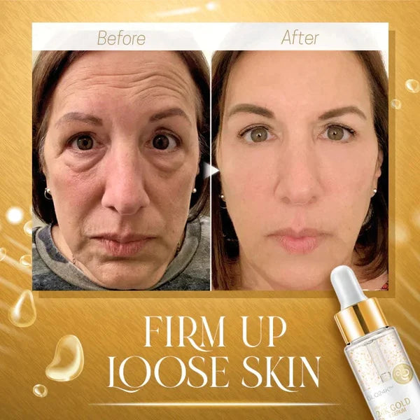 Norvo | 24K Gull Kollagen Serum for Hudforyngelse