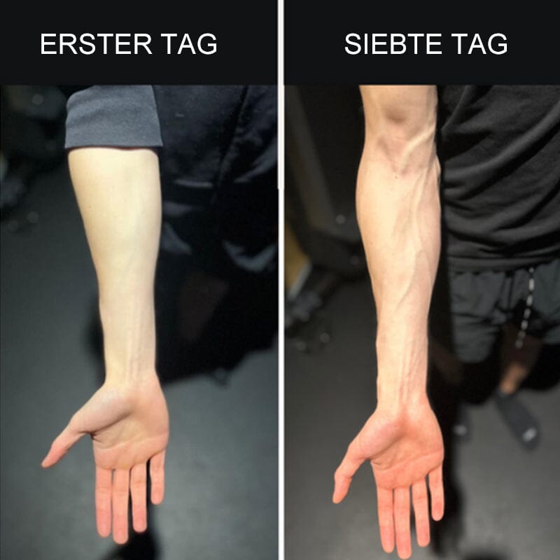 Norvo | Silikon Finger Treningstrener