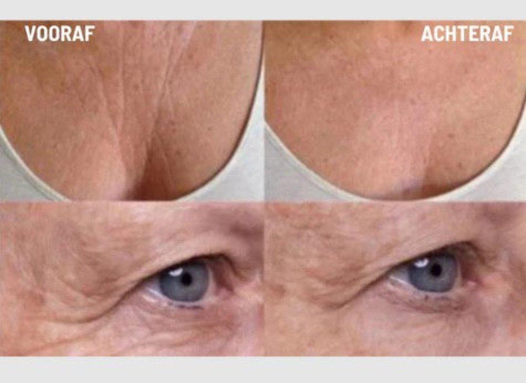 Norvo | Anti-rynke silikonputer