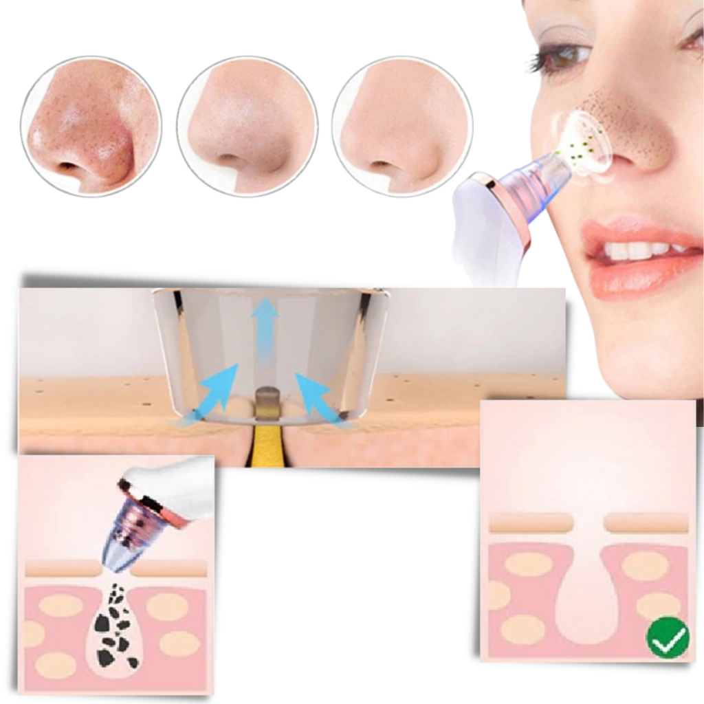 Hudormefjerner