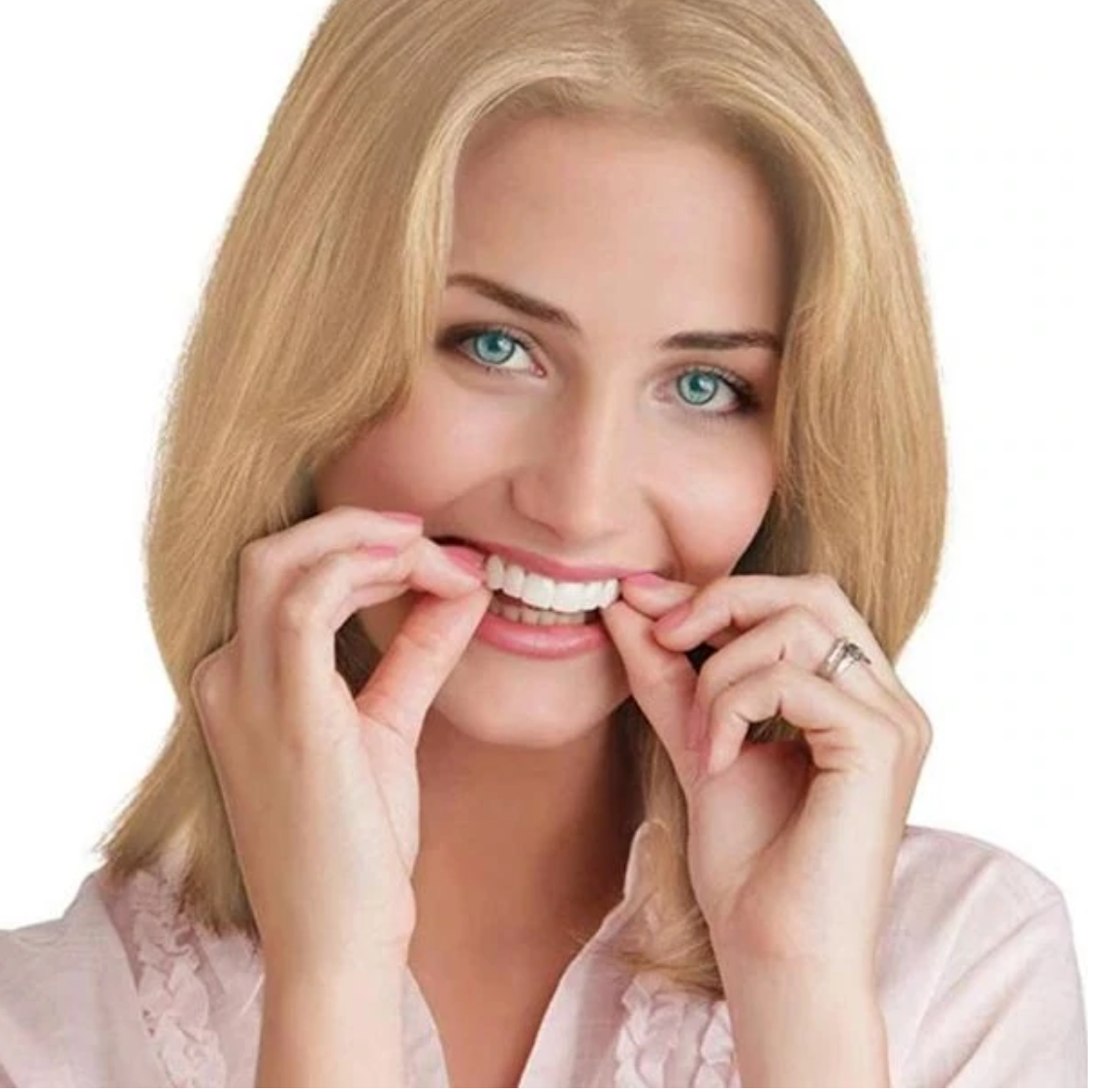 Norvo | HappySmile Facet sett | Gjenbrukbare øvre og nedre fasetter for et strålende smil