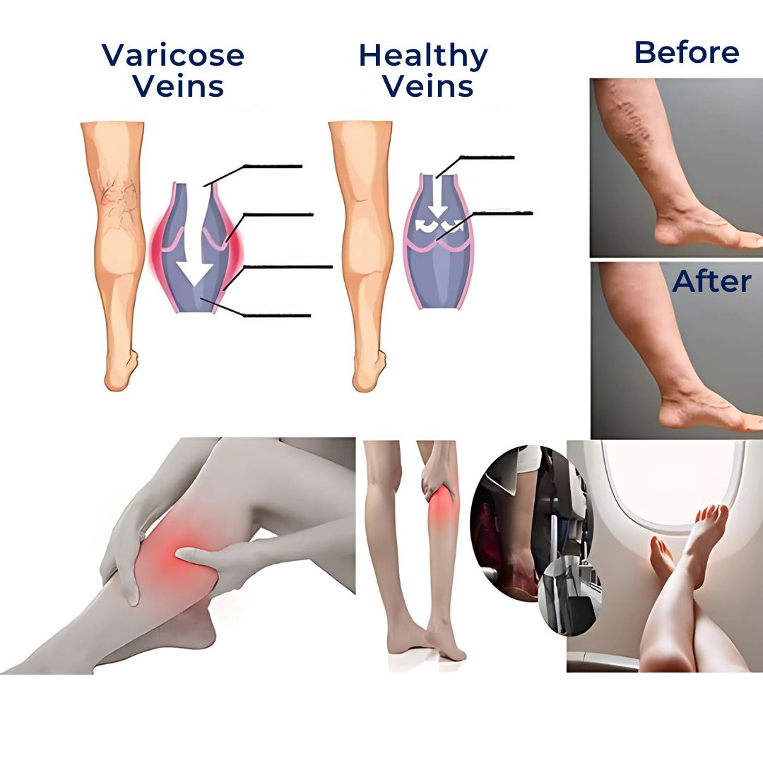Norvo | CircuEase kompresjonssokker | Myk, høyt elastisk design for muskelgjenoppretting og sirkulasjonsforbedring for profesjonelle på beina