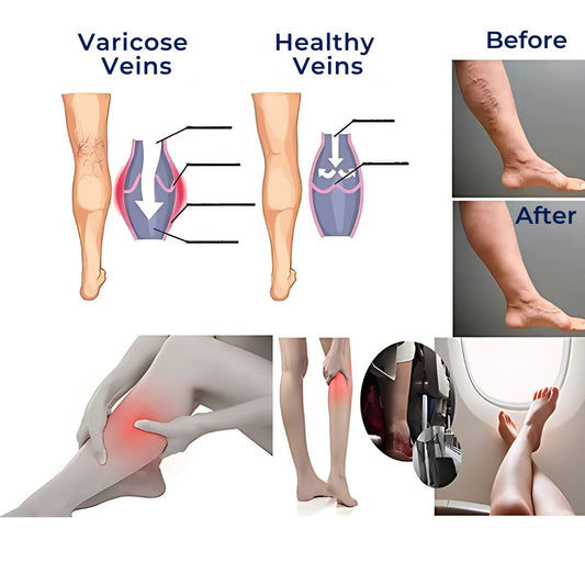 Norvo | CircuEase kompresjonssokker | Myk, høyt elastisk design for muskelgjenoppretting og sirkulasjonsforbedring for profesjonelle på beina